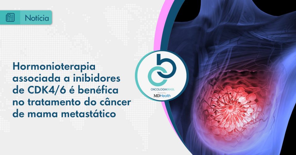 O uso de terapia endócrina é padrão para o tratamento do câncer de mama metastático positivo para receptores hormonais e negativo para expressão de HER2.