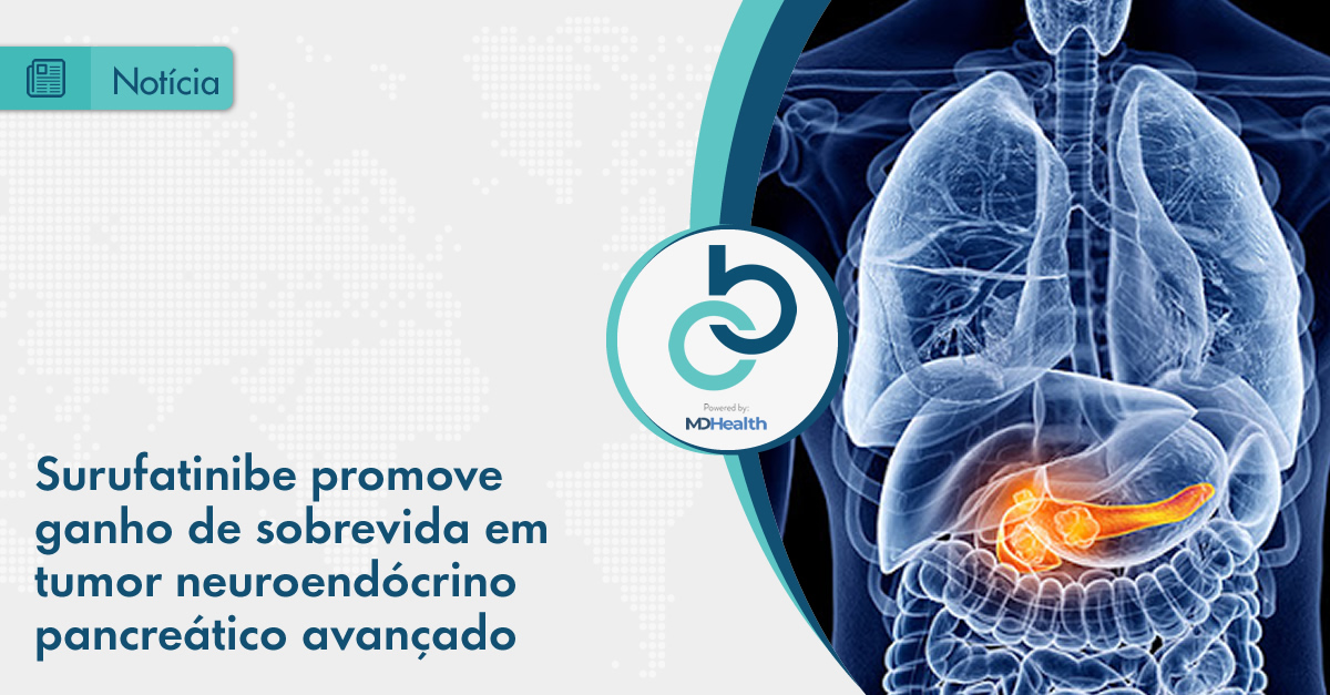 Surufatinibe promove ganho de sobrevida em tumor neuroendócrino pancreático avançado