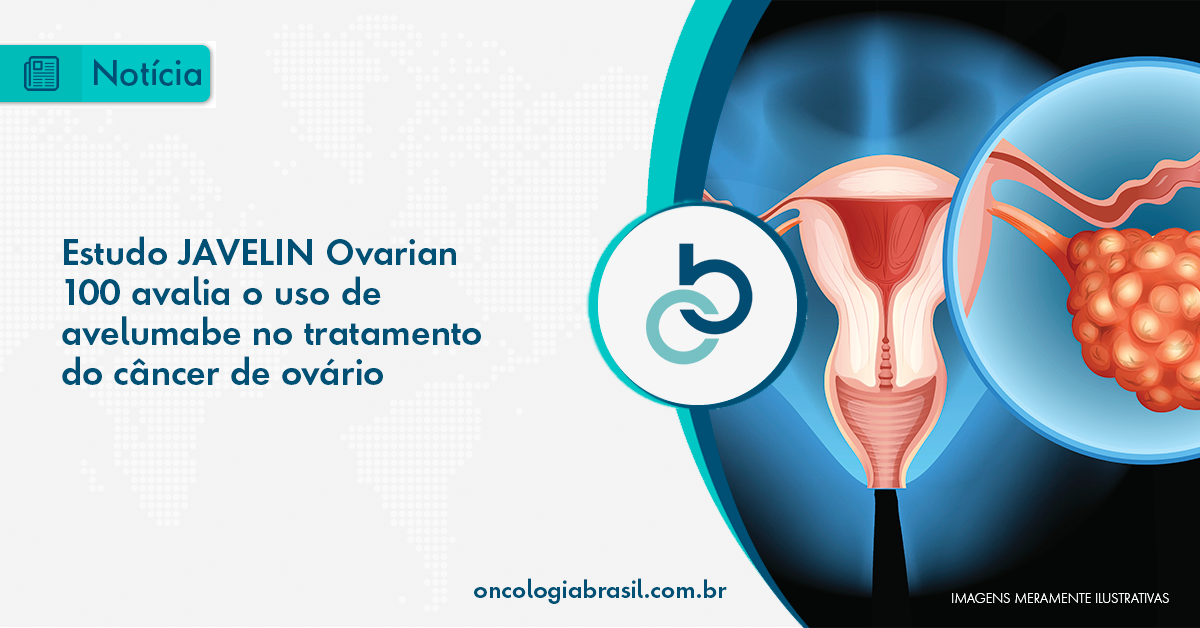 Estudo JAVELIN Ovarian 100 avalia o uso de avelumabe no tratamento